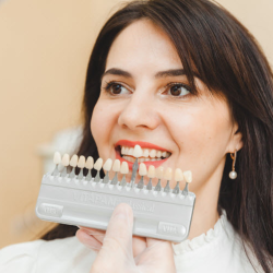Veneers