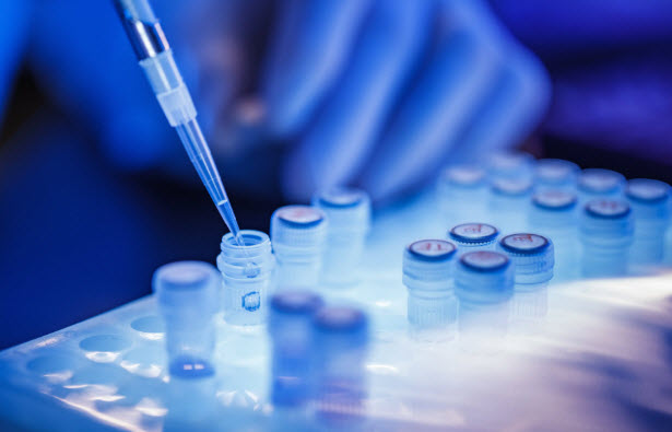 Oncotype DX Breast DCIS Score® test