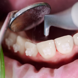 Periodontal & Gum Health