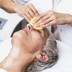 Chemical Peel