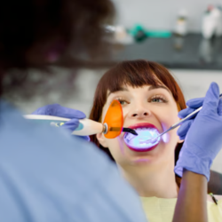 Fluoride Treatment