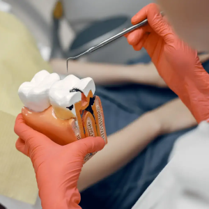 Fillings