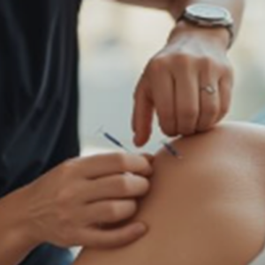 In Home Dry Needling