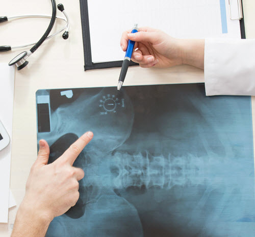 X-Ray on Site