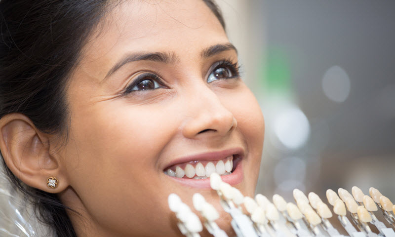 Dental Veneers