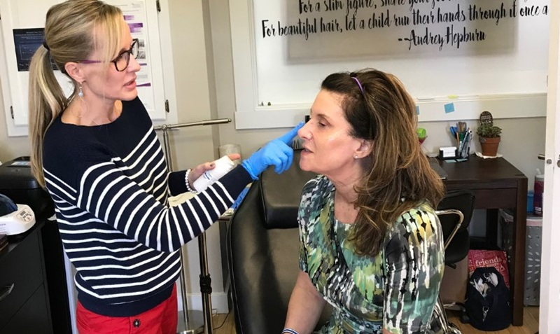 Scarlet RF Microneedling