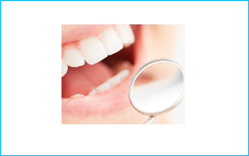 Dental Cleanings