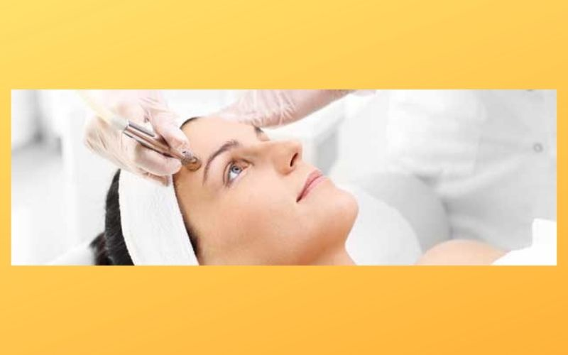 Microdermabrasion