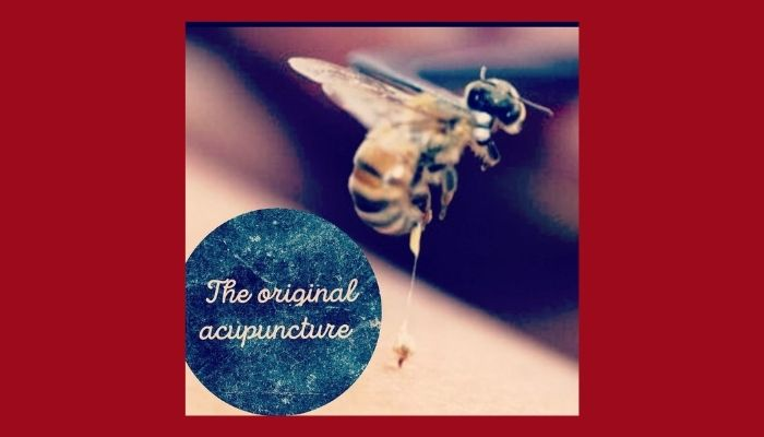 Bee Sting Therapy
