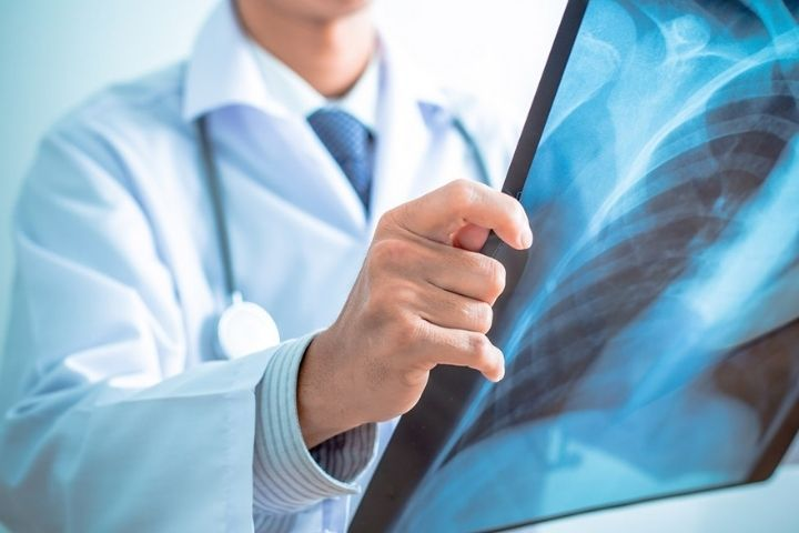 X-ray