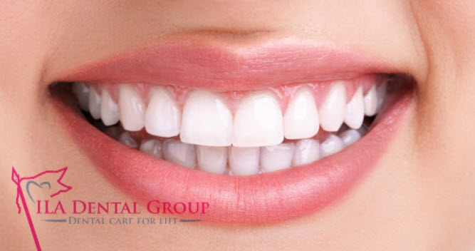 Receding Gums