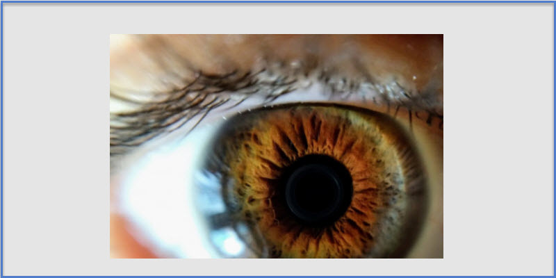 Iridology Evaluation