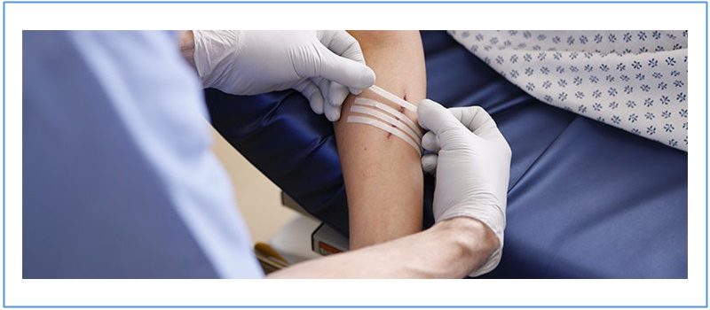 In-Office Treatments & Procedures