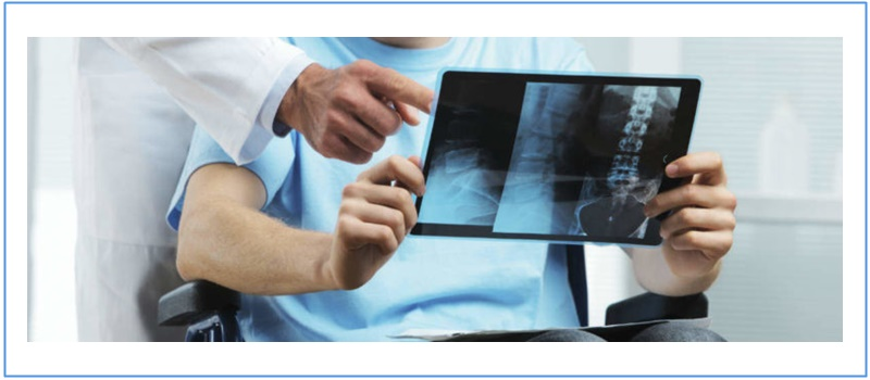 Personal Injury Accidents
