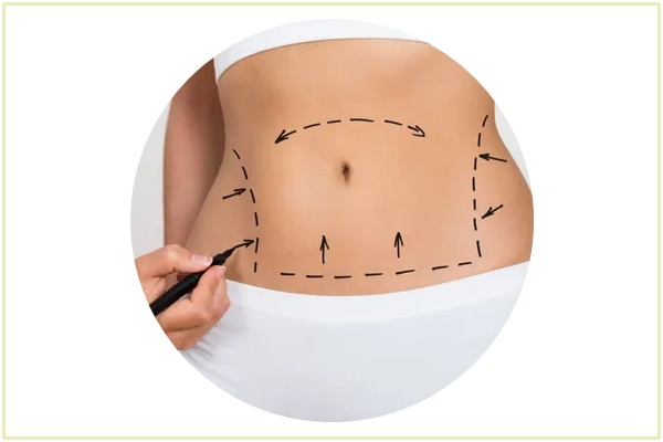 Surgical & Postpartum Issues