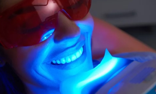 LED Teeth Whitening