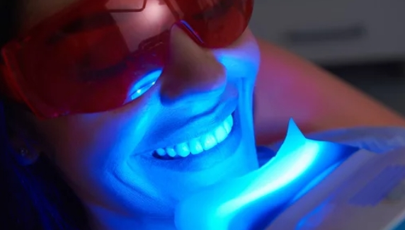 Teeth Whitening