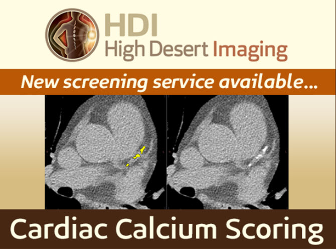 Cardiac Calcium Scoring Screening