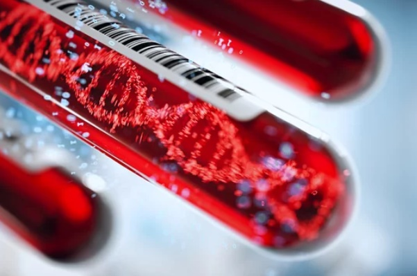  Colorectal Cancer Blood