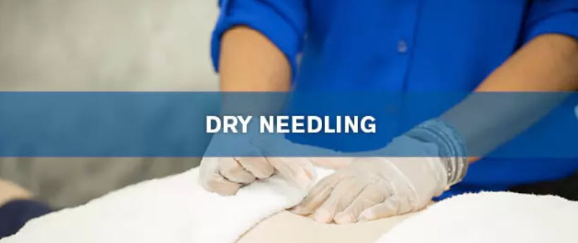 Dry Needling