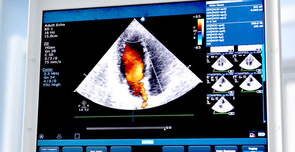 Ultrasound