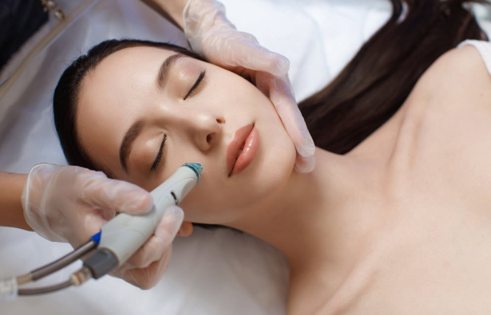 Microneedling