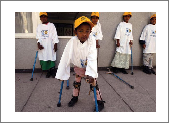 Polio Plus and Rotarplast Support