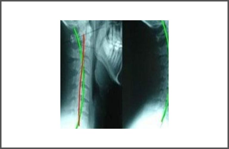 Chiropractic Postural Specific X-rays