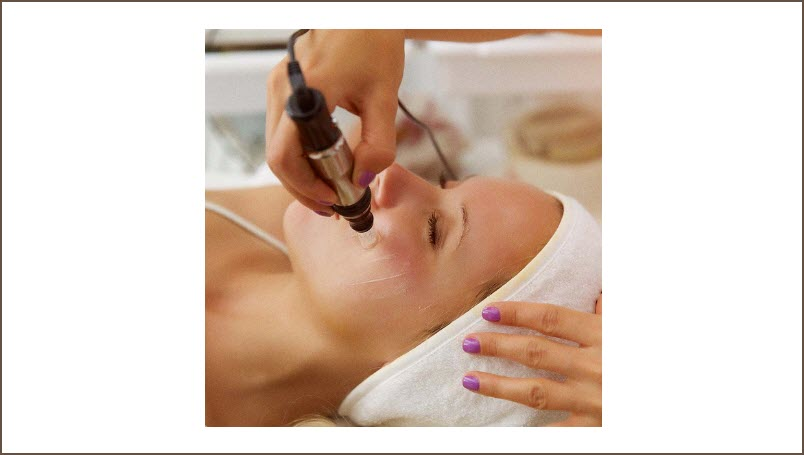 Microneedling