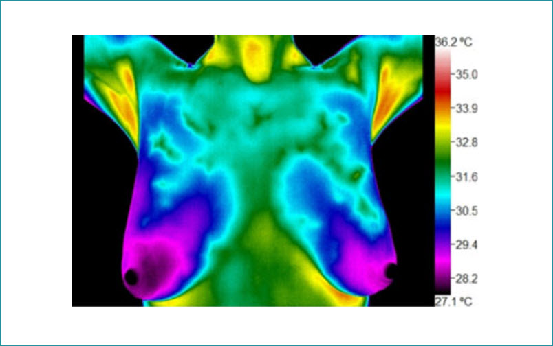 Breast Thermography