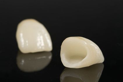 Dental Crowns 