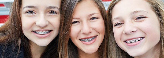 Braces