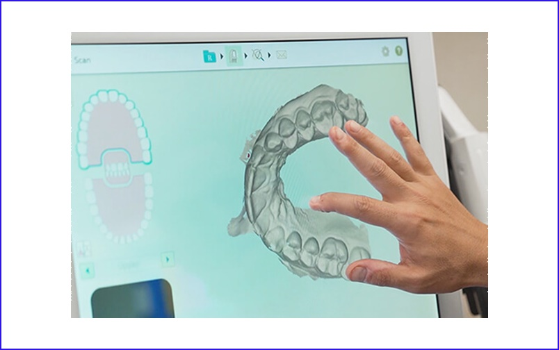 Digital Dentistry
