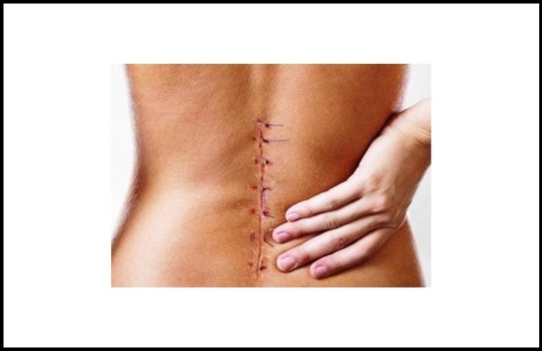 Accident Rehabilitation