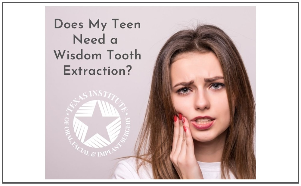 Wisdom Tooth Extraction