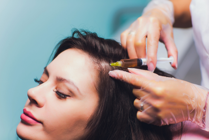 PRP Hair Restoration Treatment