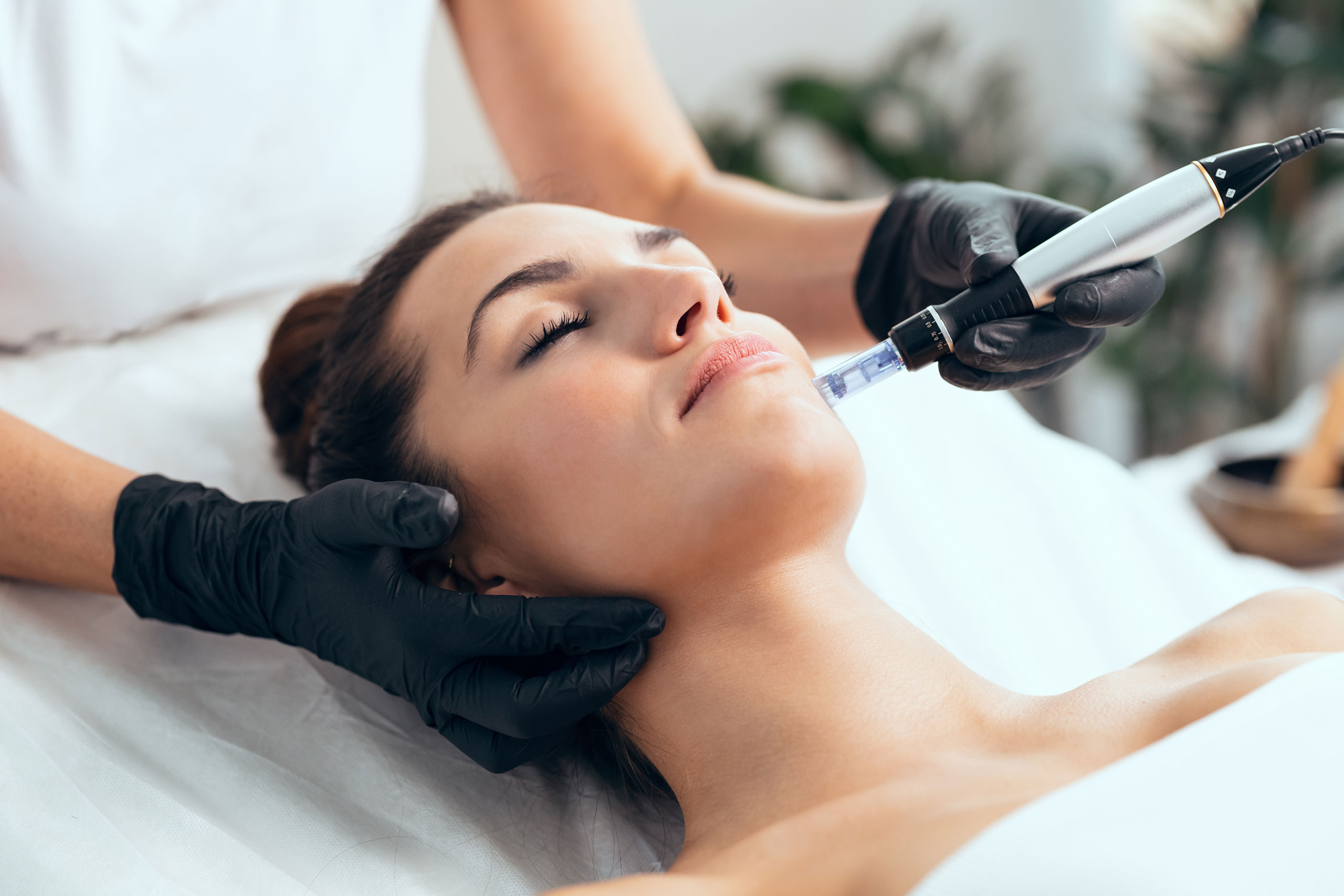 PRP Microneedling Facial