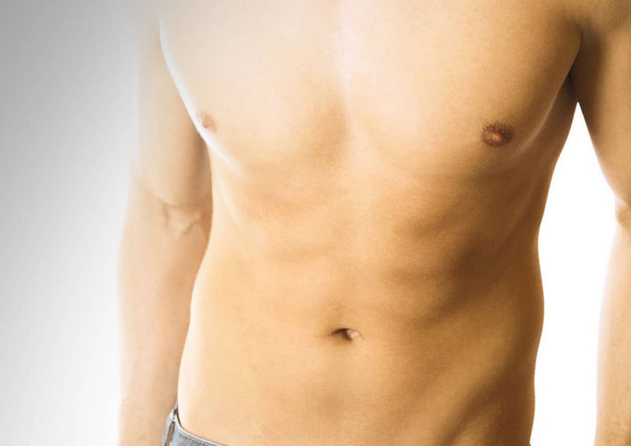 Gynecomastia Surgery