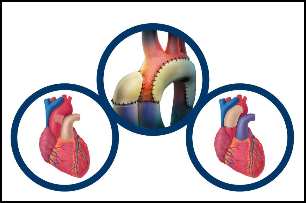Cardiac
