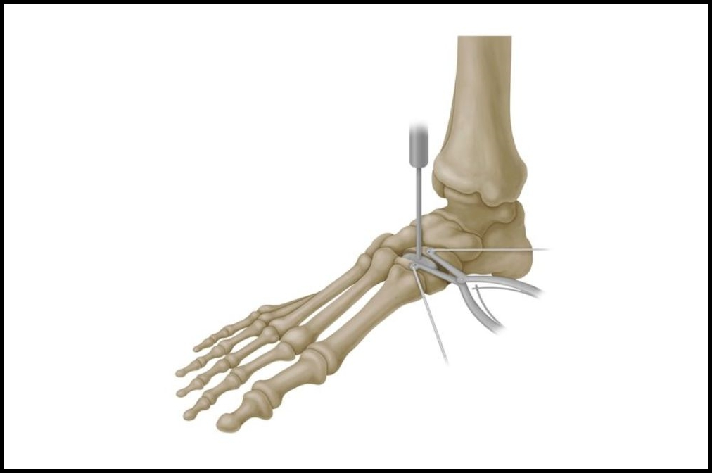 Trauma and Extremities