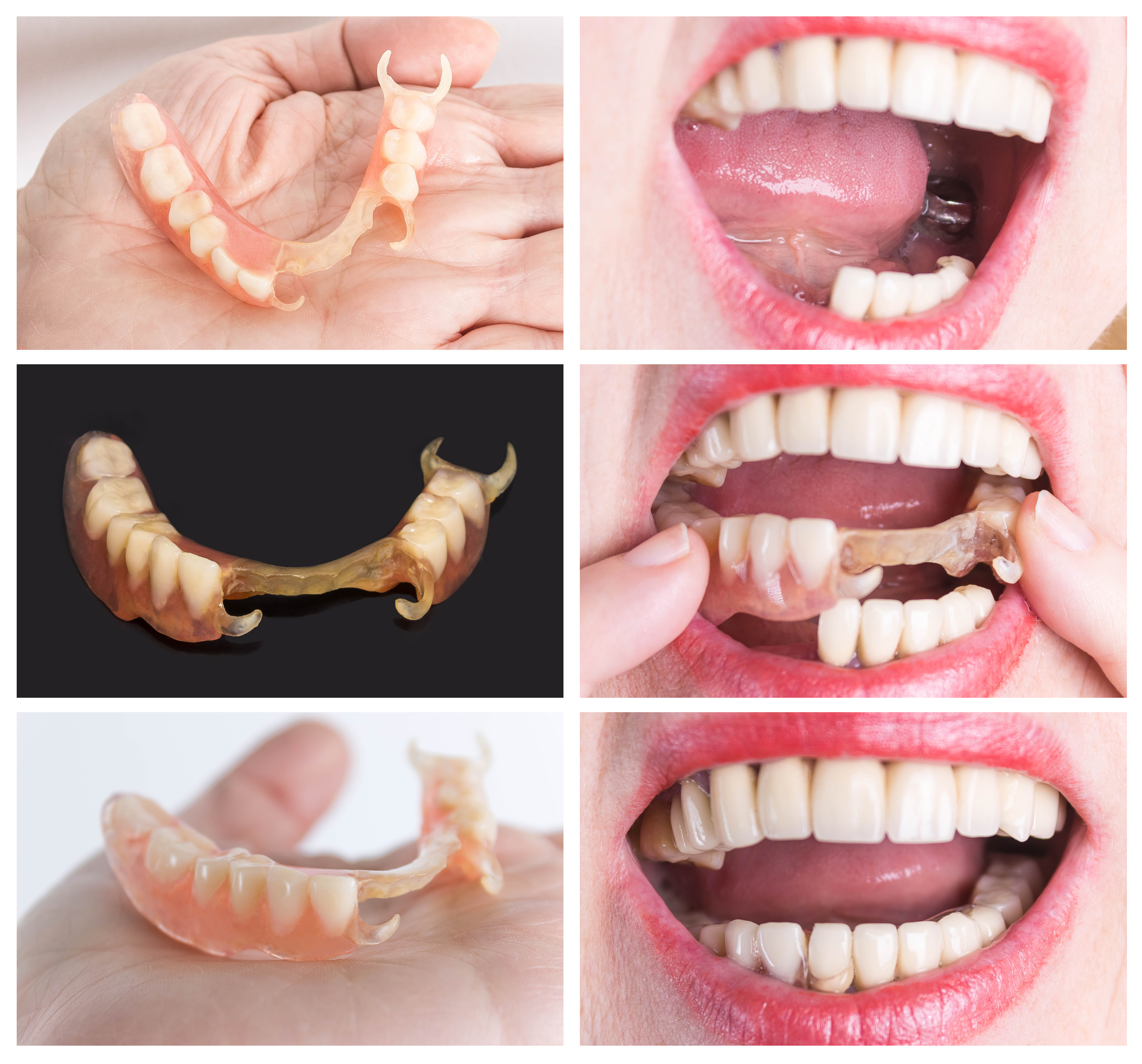 Partials and Dentures