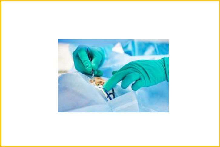 Cataracts Treatment