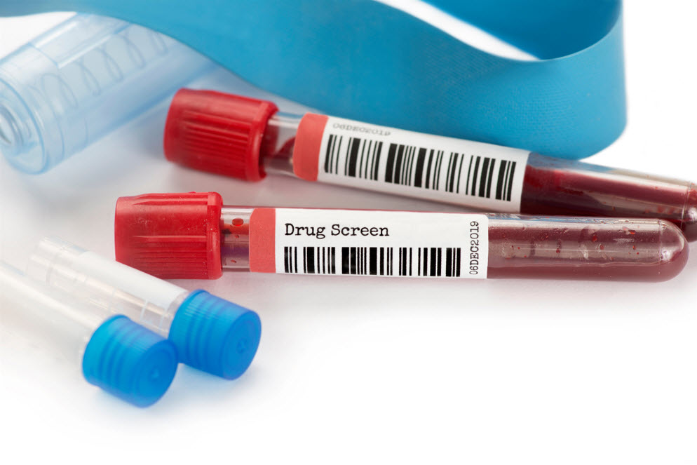 Pre-Employment Drug screenings