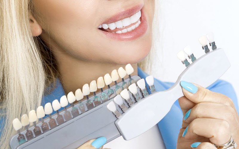 Porcelain Veneers