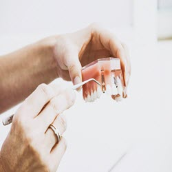 Teeth Bridges