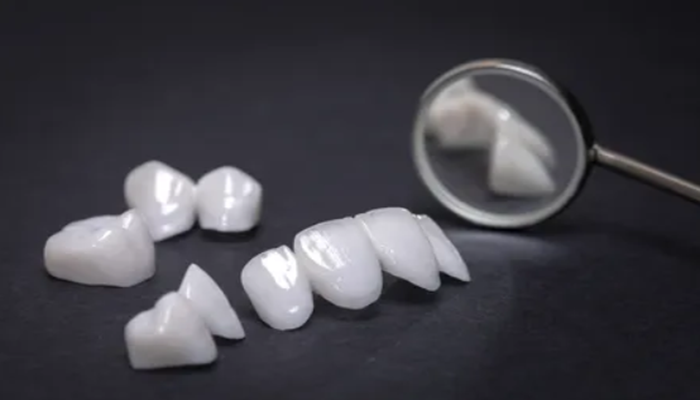 Tooth Colored Fillings, Crowns, and Veneers