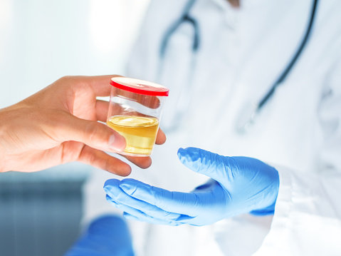 Urine Drug Tests