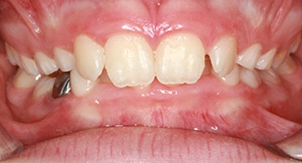 Common Ortho Problems