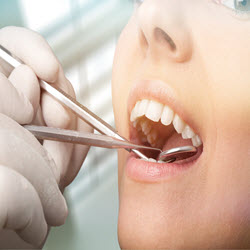 Periodontal services