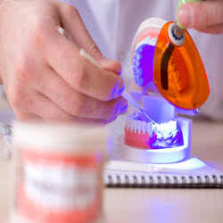 Endodontic Therapy (Root canals)